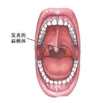 ׻᲻ᰩ ʰź